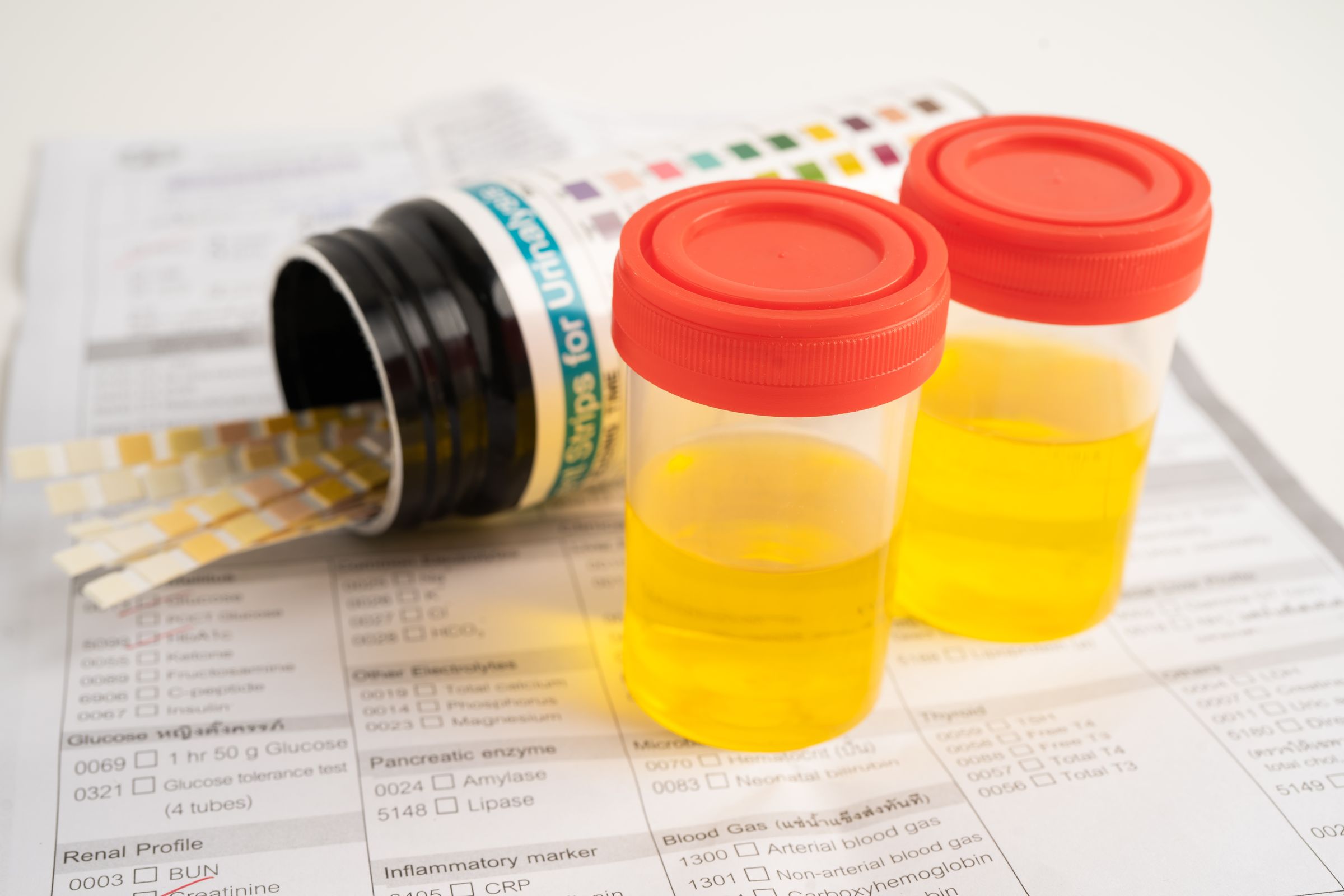 Two sample cups and a tub of test strips on a pathology request form
